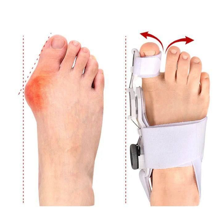 Corrector de juanete con boton ajustable